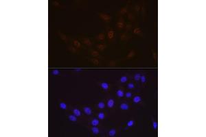 Immunofluorescence analysis of NIH-3T3 cells using Rad23A Rabbit mAb (ABIN7269824) at dilution of 1:100 (40x lens). (RAD23A anticorps)