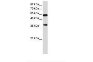 Image no. 1 for anti-AT Rich Interactive Domain 3B (BRIGHT-Like) (ARID3B) (C-Term) antibody (ABIN6736169) (ARID3B anticorps  (C-Term))