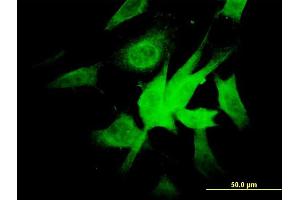 Immunofluorescence of monoclonal antibody to NDUFA9 on NIH/3T3 cell. (NDUFA9 anticorps  (AA 303-377))