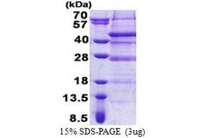 SDS-PAGE (SDS) image for Retinoic Acid Induced 12 (RAI12) (AA 1-316) protein (His tag) (ABIN5853172)