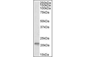 NSG1 Antibody  staining of fetal Mouse Brain lysate at 0. (NSG1 anticorps  (N-Term))