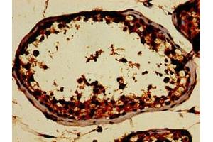 Immunohistochemistry of paraffin-embedded human testis tissue using ABIN7162483 at dilution of 1:100