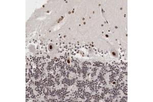 Immunohistochemical staining of human cerebellum with DACH2 polyclonal antibody  shows distinct nuclear positivity in cerebellar tissue at 1:50-1:200 dilution. (DACH2 anticorps  (AA 215-333))