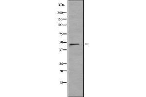 Western blot analysis of LRRC42 expression in HT1080 cell lysate,The lane on the left is treated with the antigen-specific peptide.