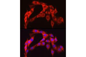 Immunofluorescence analysis of PC-12 cells using S6 Ribosomal Protein (RPS6) Rabbit pAb (ABIN6133901, ABIN6147227, ABIN6147228 and ABIN6221687) at dilution of 1:100 (40x lens).