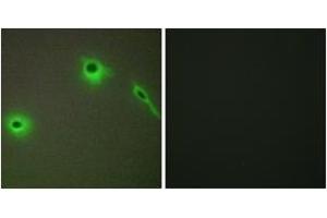Immunofluorescence analysis of A549 cells, using Collagen XVIII alpha1 Antibody. (COL18A1 anticorps  (AA 801-850))