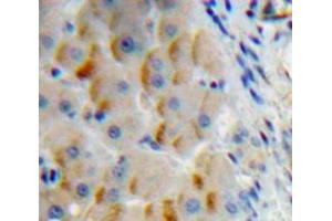 Used in DAB staining on fromalin fixed paraffin-embedded Liver tissue (Insulin Receptor anticorps  (AA 1027-1364))