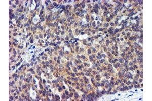 Image no. 4 for anti-Metalloproteinase Inhibitor 2 (TIMP2) antibody (ABIN1501394) (TIMP2 anticorps)