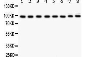 Anti- TFRC antibody, Western blotting All lanes: Anti TRFC  at 0. (Transferrin Receptor anticorps  (AA 1-198))