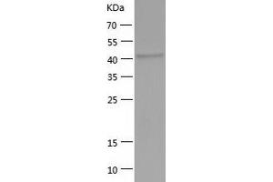 Western Blotting (WB) image for serpin Peptidase Inhibitor, Clade I (neuroserpin), Member 1 (SERPINI1) (AA 17-410) protein (His-IF2DI Tag) (ABIN7125056)