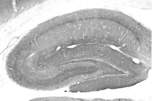 Adult rat hippocampus immunohistochemistry. (DLX1 anticorps  (AA 53-74))