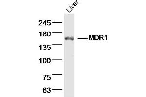 Rat liver lysates probed with MDR1 Polyclonal Antibody, Unconjugated  at 1:300 dilution and 4˚C overnight incubation.