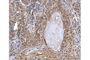 IHC analysis of MRE11 using anti-MRE11 antibody (ABIN7601056). (Mre11 anticorps  (AA 278-498))
