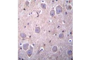 Formalin fixed, paraffin embedded human brain tissue stained with RAP1GDS1 Antibody  followed by peroxidase conjugation of the secondary antibody and DAB staining. (RAP1GDS1 anticorps  (Middle Region))