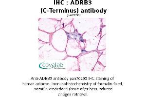 Image no. 1 for anti-Adrenergic, beta-3-, Receptor (ADRB3) (C-Term) antibody (ABIN1731585)
