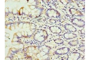 Immunohistochemistry of paraffin-embedded human small intestine tissue using ABIN7152051 at dilution of 1:100