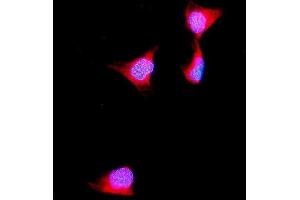anti-Aldolase B, Fructose-Bisphosphate (ALDOB) (AA 85-364) antibody