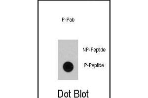 Dot blot analysis of anti-RAF1 Phospho-specific Pab (ABIN389895 and ABIN2839736) on nitrocellulose membrane. (RAF1 anticorps  (pSer339))