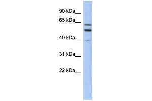 WB Suggested Anti-TMCC1 Antibody Titration:  0. (TMCC1 anticorps  (Middle Region))