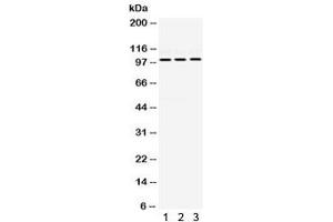 Western blot testing of human 1) HeLa, 2) MCF7 and 3) SMMC cell lysate with RASGAP antibody. (RASA1 anticorps)