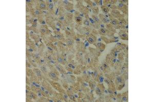 Immunohistochemistry of paraffin-embedded mouse heart using CCBL1 antibody at dilution of 1:100 (x40 lens). (CCBL1 anticorps)