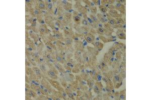 Immunohistochemistry of paraffin-embedded mouse heart using CCBL1 antibody at dilution of 1:100 (x40 lens). (CCBL1 anticorps)