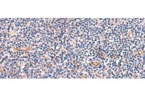 Immunohistochemistry of paraffin-embedded Human tonsil tissue using INSM2 Polyclonal Antibody at dilution of 1:35(x200)