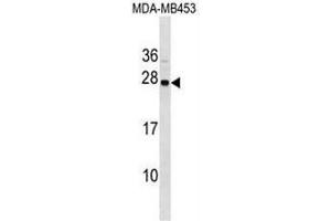 SYNGR1 Antibody (C-term) western blot analysis in MDA-MB453 cell line lysates (35µg/lane). (Synaptogyrin 1 anticorps  (C-Term))