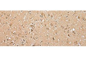 Immunohistochemistry of paraffin-embedded Human brain tissue using ATXN7L3 Polyclonal Antibody at dilution of 1:35(x200)