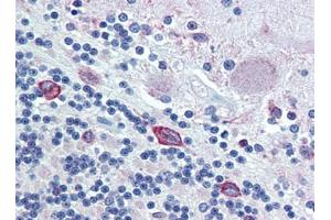 Brain, cerebellum, Human: Formalin-Fixed, Paraffin-Embedded (FFPE) (PDIA4 anticorps  (AA 623-638))