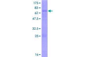 Image no. 1 for Carbohydrate (N-Acetylgalactosamine 4-0) Sulfotransferase 14 (CHST14) (AA 1-376) protein (GST tag) (ABIN1349436)