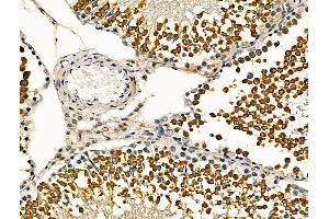 ABIN6264808 and ABIN6276442 at 1/100 staining Rat testis tissue by IHC-P. (RPA1 anticorps  (Internal Region))