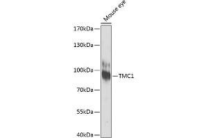Western blot analysis of extracts of mouse eye, using TMC1 antibody (ABIN6134923, ABIN6149240, ABIN6149242 and ABIN6224704) at 1:1000 dilution. (TMC1 anticorps  (AA 600-700))