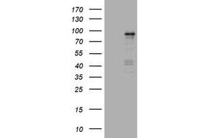 Image no. 1 for anti-Nibrin (NBN) (AA 461-754) antibody (ABIN1491541) (Nibrin anticorps  (AA 461-754))