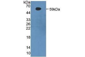 Detection of Recombinant bACE1, Human using Polyclonal Antibody to Beta-Site APP Cleaving Enzyme 1 (bACE1) (BACE1 anticorps  (AA 170-428))