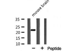 Western blot analysis of extracts from mouse Brian cells using PPIF antibody. (PPIF anticorps  (Internal Region))