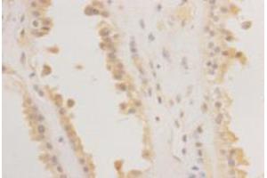 Immunohistochemistry (Paraffin-embedded Sections) (IHC (p)) image for anti-RAS (RAD and GEM)-Like GTP Binding 2 (REM2) antibody (ABIN1112927) (REM2 anticorps)