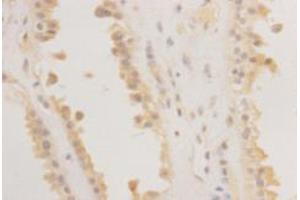 Immunohistochemistry (Paraffin-embedded Sections) (IHC (p)) image for anti-RAS (RAD and GEM)-Like GTP Binding 2 (REM2) antibody (ABIN1112927)