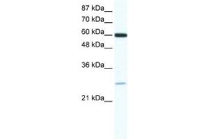 ZFP91 antibody used at 0. (ZFP91 anticorps  (N-Term))