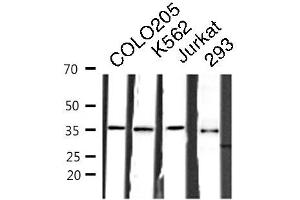 Western blot analysis of COLO205/K562/JURKAT/293 cell lysates using RNF113B antibody. (RNF113B anticorps  (Internal Region))