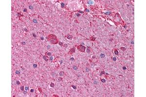 Anti-CHRNB3 antibody IHC of human brain, cortex.