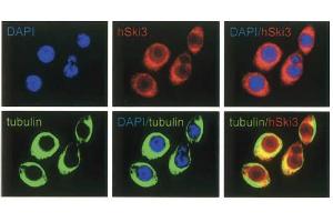 Immunofluorescence Microscopy of anti-SKI3 antibody Immunofluorescence Microscopy results of Rabbit anti-SKI3 antibody. (TTC37 anticorps)