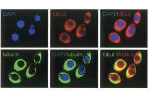Immunofluorescence Microscopy of anti-SKI3 antibody Immunofluorescence Microscopy results of Rabbit anti-SKI3 antibody. (TTC37 anticorps)