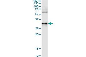 Immunoprecipitation of ANXA3 transfected lysate using anti-ANXA3 monoclonal antibody and Protein A Magnetic Bead , and immunoblotted with ANXA3 MaxPab rabbit polyclonal antibody.