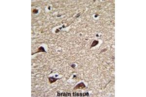 Immunohistochemistry (IHC) image for anti-6-phosphogluconolactonase (PGLS) antibody (ABIN3001729)