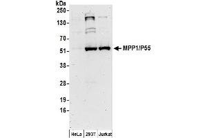 Western Blotting (WB) image for anti-Membrane Protein, Palmitoylated 1, 55kDa (MPP1) (AA 1-50) antibody (ABIN7449770)