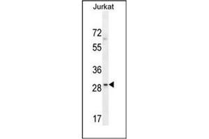 Western blot analysis of LRRC25 Antibody (C-term) in Jurkat cell line lysates (35ug/lane). (LRRC25 anticorps  (C-Term))