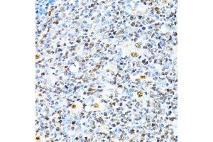 Immunohistochemistry of paraffin-embedded human appendix using XRCC4 antibody (ABIN3022381, ABIN3022382, ABIN3022383 and ABIN6218772) at dilution of 1:100 (40x lens).