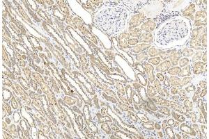 Immunohistochemical analysis of paraffin-embedded Human kidney section using Pink1 am2250b.