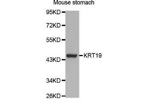 Western Blotting (WB) image for anti-Keratin 19 (KRT19) (AA 241-400) antibody (ABIN3020779)